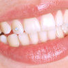 _100_sourire_avec_bijou